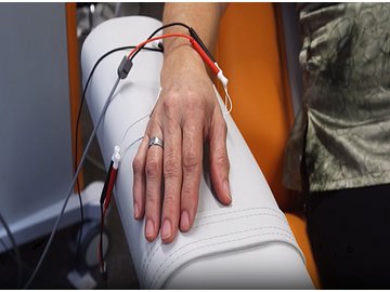 Carpal Tunnel Syndrome - Understanding Carpal Tunnel Syndrome