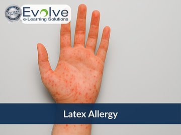 Latex Allergy